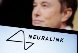 "Neuralink" implantı üçüncü insanının beyninə qoyuldu