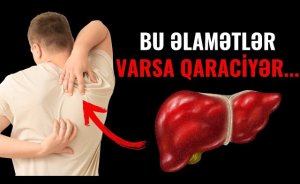 Qaraciyərdə xəstəlik olduğunu ayağın altından bilmək olurmuş— Həkimdən vacib açıqlama