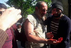 Polis erməni deputatı döyüb xəstəxanalıq etdi - FOTO