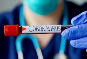 Koronavirus ABŞ-ın 34 ştatına yayıldı