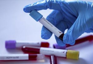 Türkiyədə koronavirusa yoluxma 3 dəfə artdı