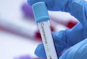 SON DƏQİQƏ! Azərbaycanda daha altı nəfərdə koronavirus aşkarlandı - RƏSMİ
