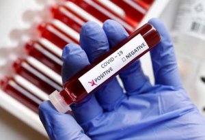 Çinin yardım üçün göndərdiyi testlərdə koronavirus aşkarlandı