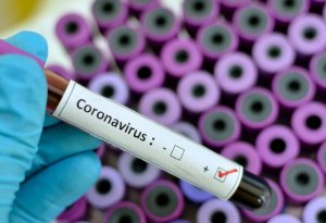 Azərbaycanda daha 471 nəfərdə koronavirus aşkarlandı - 5 nəfər öldü