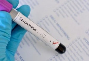 Azərbaycanda daha 478 nəfərdə koronavirus aşkarlandı