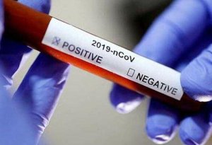 Evdə müalicə olunan koronaviruslu xəstələr üçün MÜHÜM XƏBƏR - Tövsiyələr açıqlandı