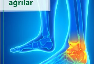 Ayaqlarda ağrıların 10 səbəbi