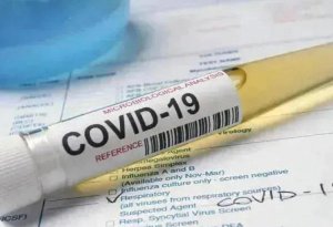 Yay aylarında Azərbaycanda koronavirusun güclü dalğası gözlənilir - Gürcü ekspert