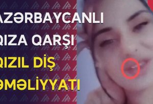 Polis qızıl dişli Ləmanı tutdu: Görün nə etdi - ŞOK VİDEO