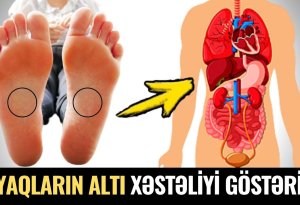 Ayaqların Altına Baxın! - 10 Saniyədə Xəstəliyinizi Biləcəksiz