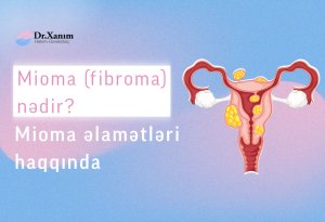 Mioma (Fibroma) və əlamətləri haqqında bilmədikləriniz - Ginekoloq Xanım Adıgözəlova