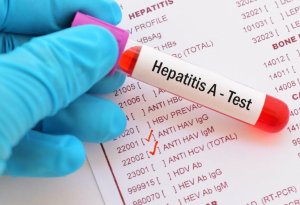 Hepatit daşıyıcıları əsgərliyə aparılmır? -AÇIQLAMA