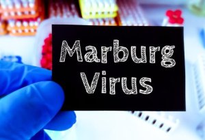 Afrikada ölümcül virus epidemiyası: yoluxanların demək olar ki, 90%-i ölür