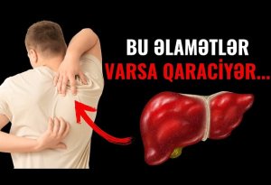 Qaraciyərdə xəstəlik olduğunu ayağın altından bilmək olurmuş— Həkimdən vacib açıqlama