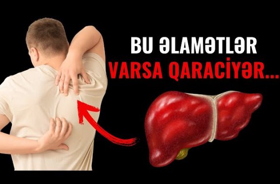 Qaraciyərdə xəstəlik olduğunu ayağın altından bilmək olurmuş— Həkimdən vacib açıqlama