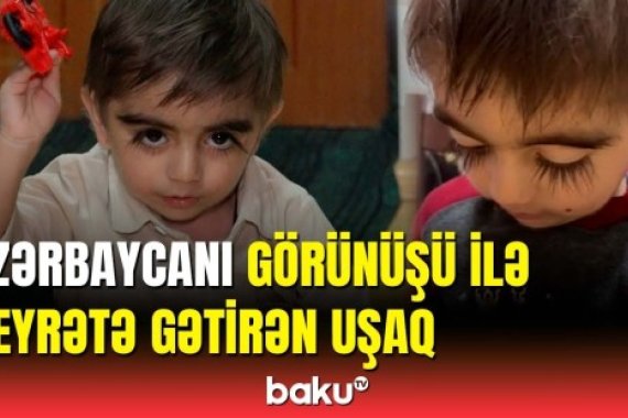 Qaş və kirpikləri ilə hamını təəccübləndirən körpənin atası Baku TV-yə danışdı