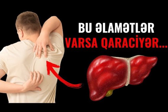 Qaraciyərdə xəstəlik olduğunu ayağın altından bilmək olurmuş— Həkimdən vacib açıqlama