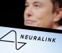 "Neuralink" implantı üçüncü insanının beyninə qoyuldu