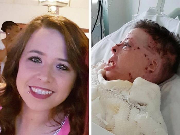 Сосед облил домохозяйку бензином, поджёг и с улыбкой смотрел, как она корчится –