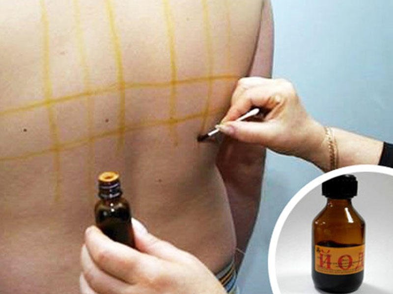 Uşağa yod çəkərkən bu məqamlara diqqət edin - PEDİATR SADALADI