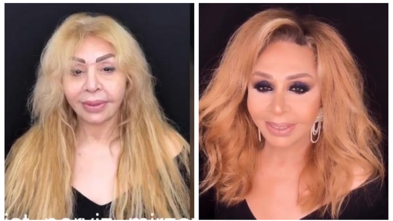 Azərbaycanlı müğənninin makiyajsız görüntüləri təəccüb doğurdu -