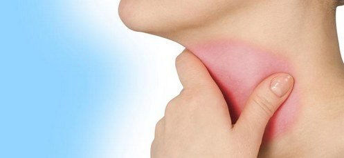 Boğazım qaşınır! Faringit və onunmüalicəsi