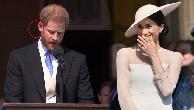 Şahzadənin qulağını arı sancdı – Görün, xanımı nə etdi – VİDEO