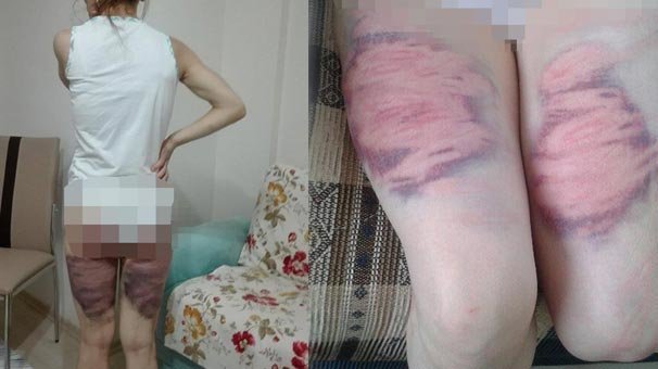 Başqa kişi ilə yazışan arvadını soyundurub oxlovla döydü, bu hala saldı (+18 FOTOLAR)