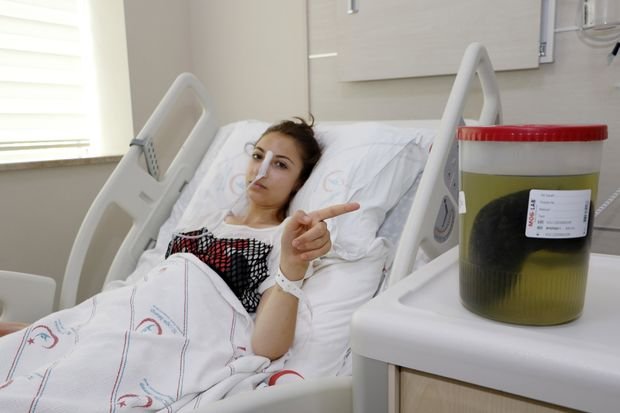 Türkiyəli gəncin mədəsindən çıxanlar həkimləri şoka saldı – FOTO