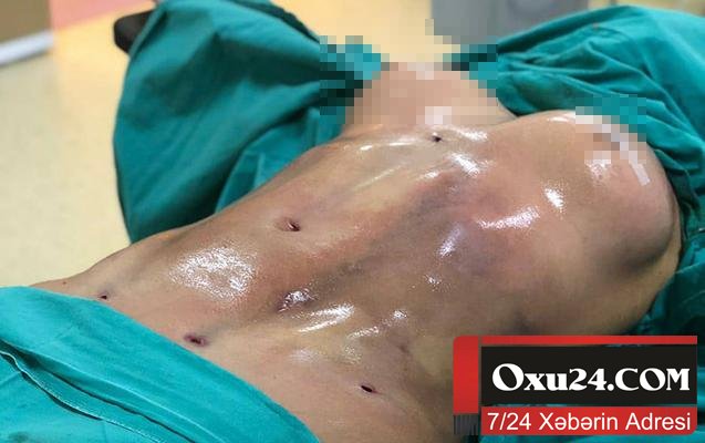 Azərbaycanda plastik cərrah xəstəni bu hala qoyub - Fotolar