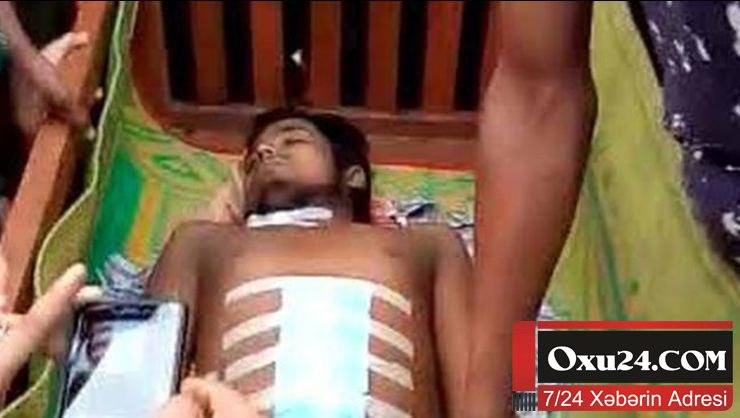 Qarnı ağrıdığına görə xəstəxanaya gedən kişinin cinsiyyət orqanını oğurladılar - FOTO