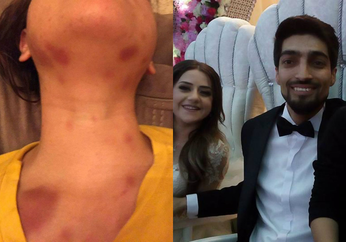 Bakıda jurnalist hamilə arvadını küçədə döyüb -