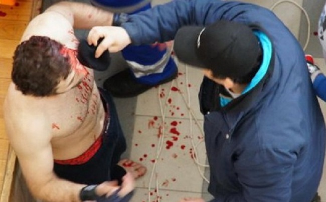 “İnfiniti”də kütləvi dava: Ərəb turisti döydülər