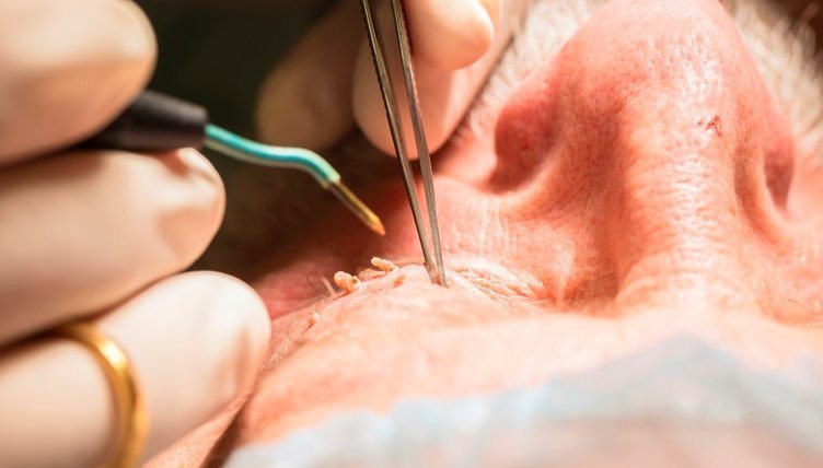 Oyanandan kirpik və ya qaşınız qaşınırsa… - 8 ayaqlı məxluq sizə də hücum edib