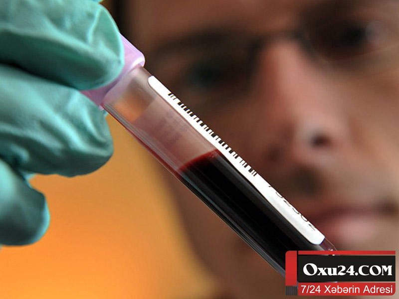 Ölən sevgilisindən hamilə qalacaq