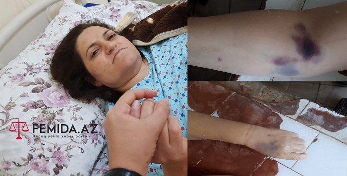 Bakıda şok! Uşaqlığı çıxarılan qadın zülümlə öldü - 18+ FOTOLAR