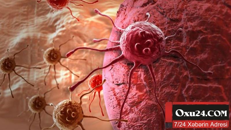 Xərçəng xəstəliyinin diaqnozu daha da asanlaşdı