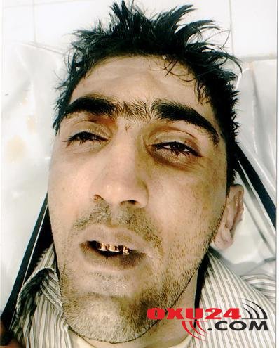 Bakı bulvarında dəhşətli hadisədə ölən şəxs kimdir? - ADI VƏ İNTİHAR SƏBƏBİ