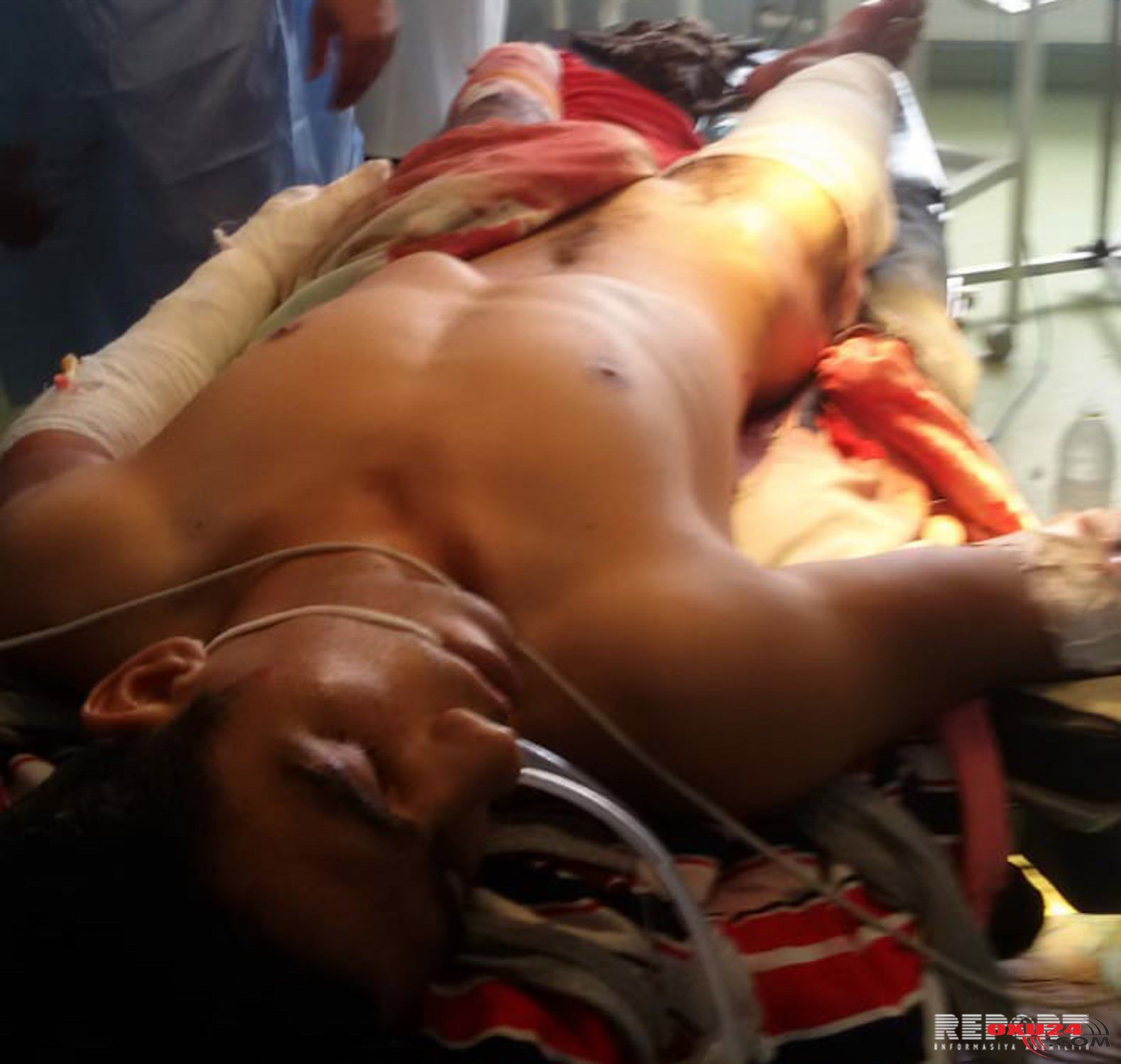 Tərtərdə minaya düşən gəncimizlə bağlı SON XƏBƏR