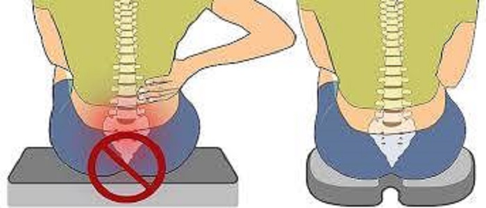 Büzdüm ağrısından əziyyət çəkənlərin NƏZƏRİNƏ! - BU YAZINI OXUYUN!