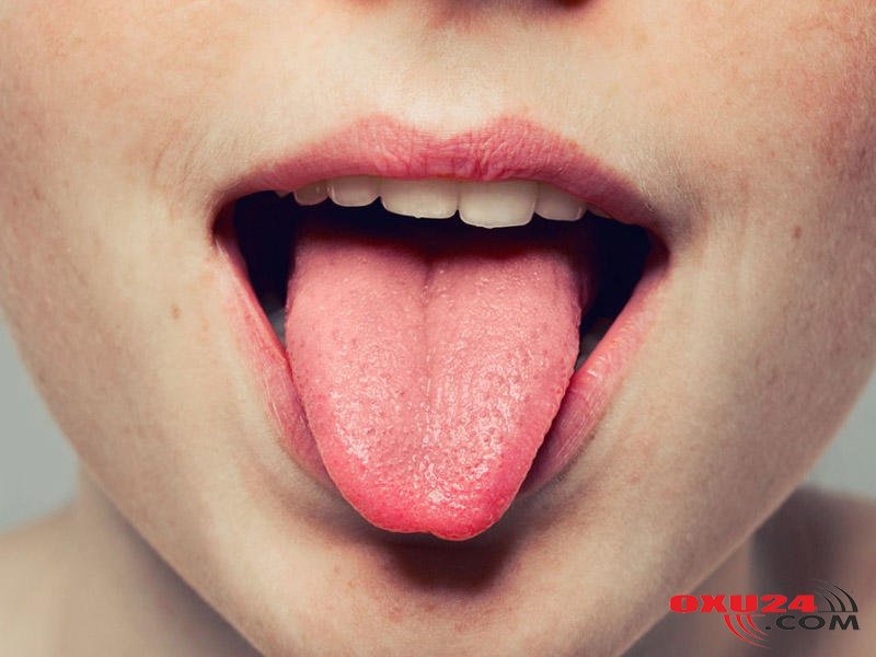 Dilinizin üstü ağdırsa - diqqətli olun