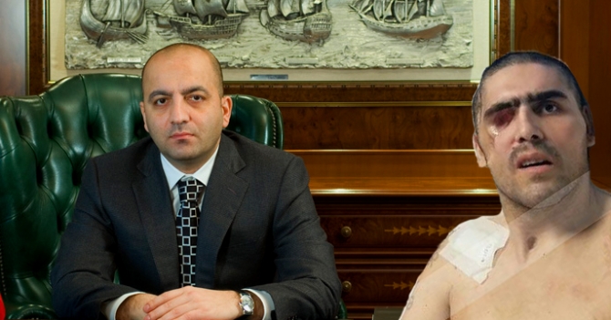 Mənsimovdan insanlıq dərsi: Komada  olan  aprel  döyüşçümüz  üçün  şəxsi  təyyarəsini təklif etdi