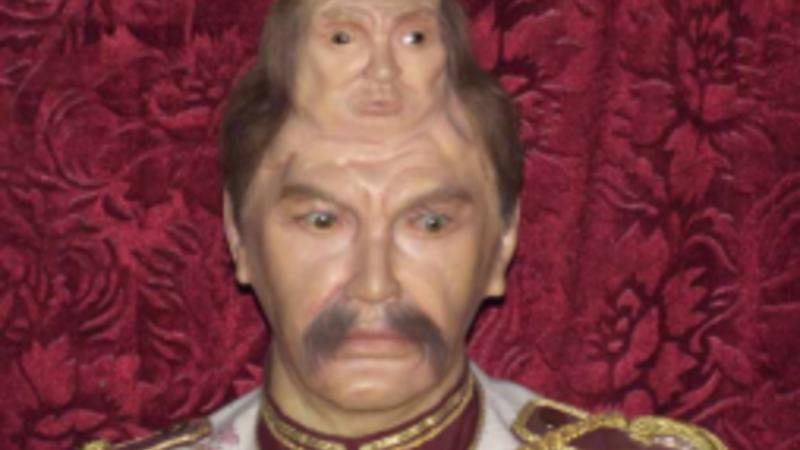 Dünyanın ikibaşlı adamı: Dəfninə qohumları gəlmədi +VİDEO