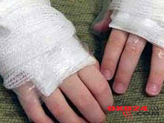 4 uşağın yanıb öldüyü FACİƏNİN TƏFƏRRÜATI: YATIBLARMIŞ...