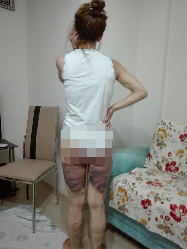 ŞOK olay: Arvadının başqa kişiyə yazdığı mesajı ələ keçirdi və bu HƏRƏKƏTİ ETDİ (FOTOLAR+VİDEO)