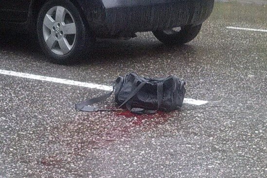 Dəhşətli qəza: Müstəntiq tanınmaz hala düşdü +VİDEO