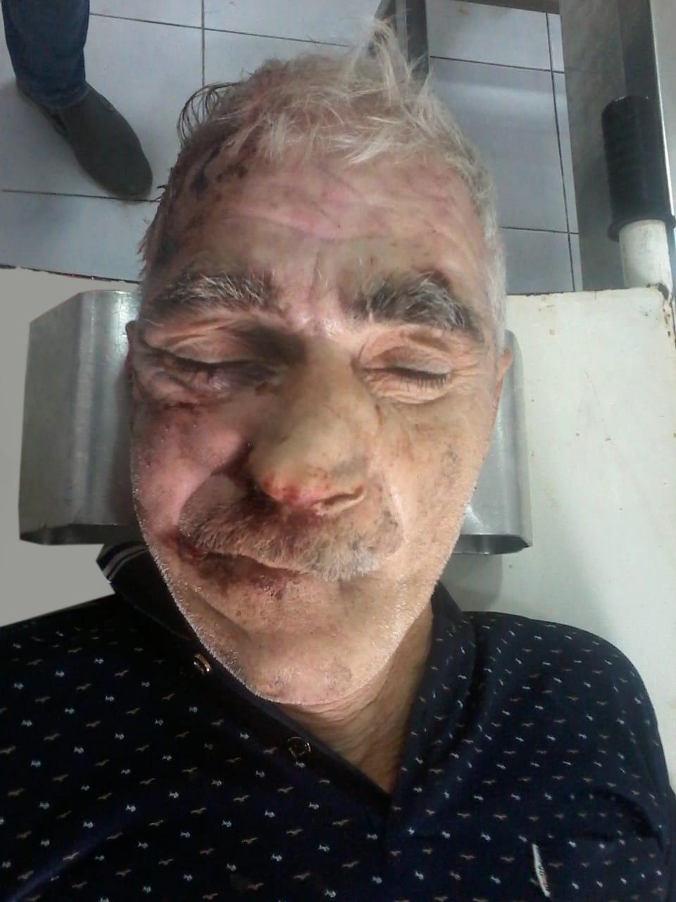 Polis əhaliyə müraciət etdi: Meyit tapılıb, sol əlinə  “Zenfira”,  sol ayağına “Çox sağ ol” yazılıb (FOTO 18+)