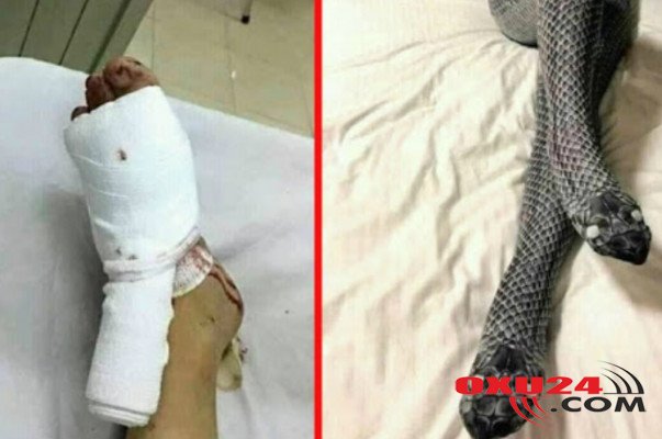 Film kimi hadisə: Ərini qorxutmaq istədi, bıçaqlandı-Foto