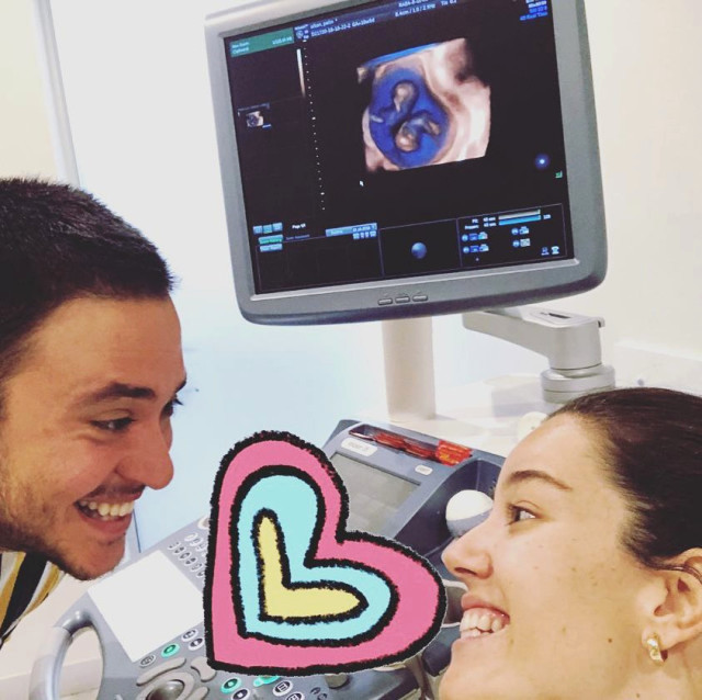 Tanınmış sənətçi \\\"donuz qripi\\\"nə yoluxdu,burnu qanadı +VİDEO