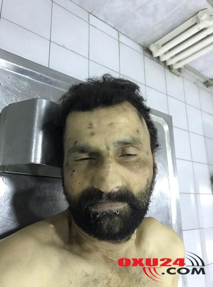 Nazirlik Bu Şəxslə Bağlı Əhaliyə Müraciət Etdi – FOTO